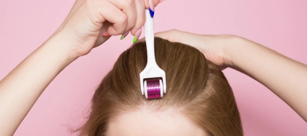 Derma roleri za rast kose su hit u svetu – Da li zaista rade posao?